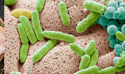 Sécurité alimentaire mondiale